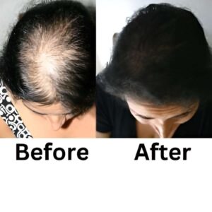 Derma Roller - Image 2