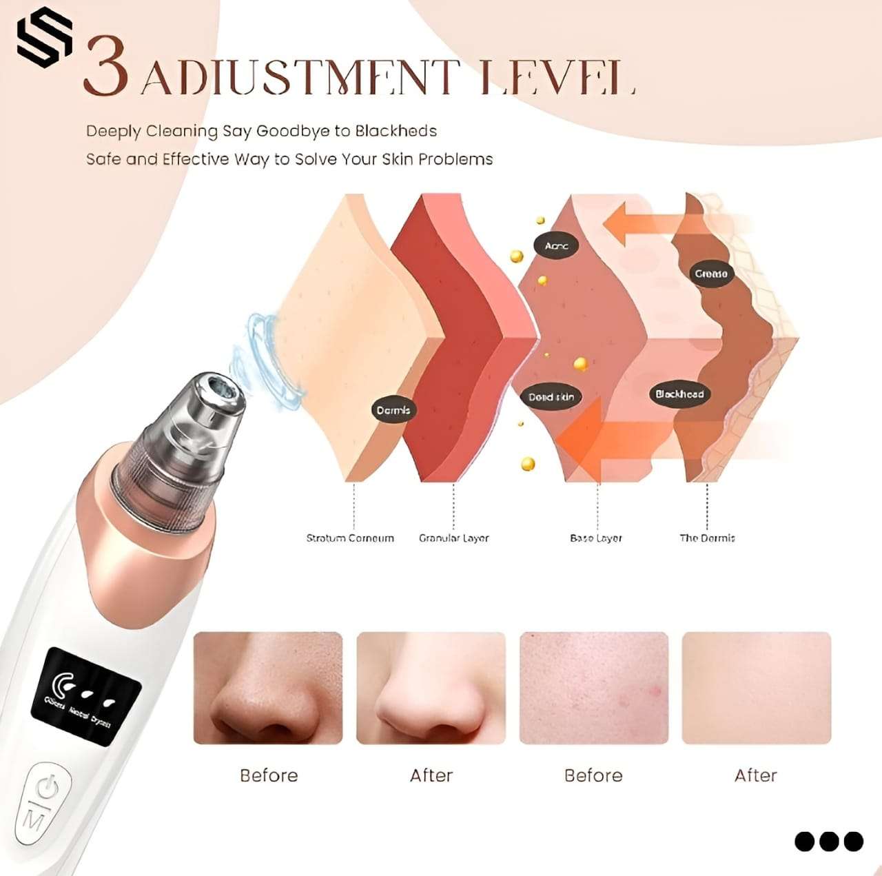 Derma Suction - Image 4